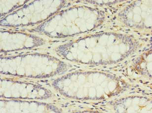 IL2 Antibody
