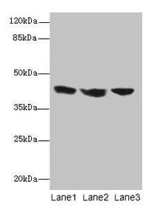 IL2RG Antibody