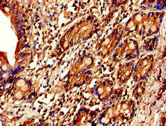 IL7R Antibody
