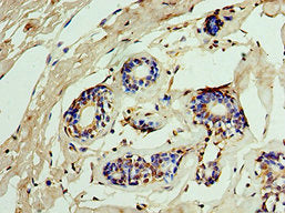 IMPDH2 Antibody