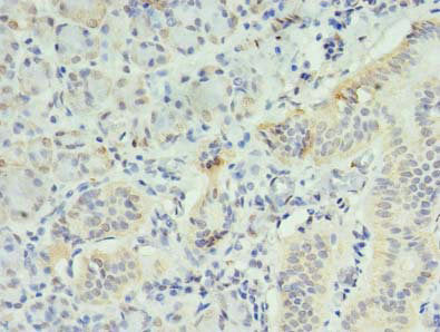 INPP1 Antibody