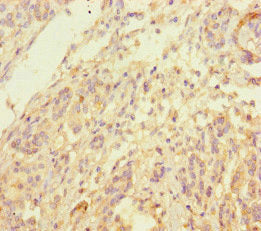 INPP4B Antibody