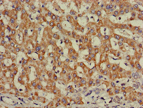 INSR Antibody