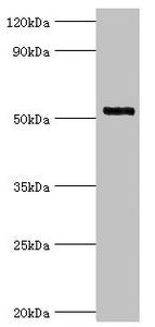 IRAK4 Antibody