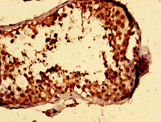 ISL1 Antibody