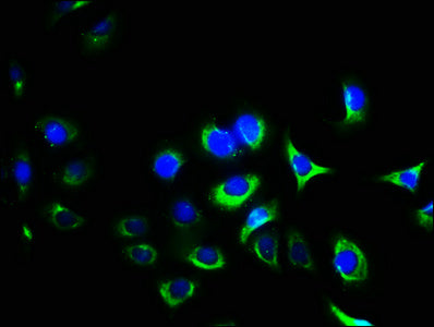ITGA2B Antibody
