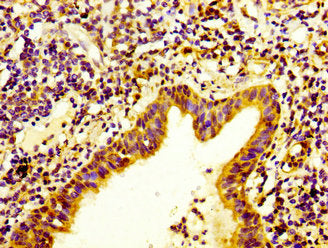 ITGA3 Antibody