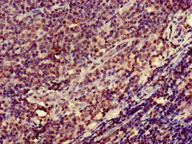ITGB2 Antibody