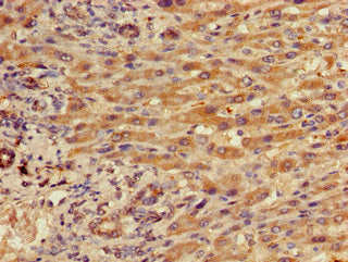 ITGB5 Antibody