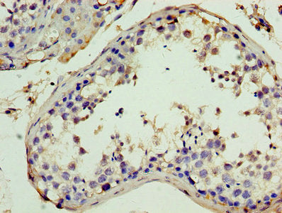 ITIH4 Antibody