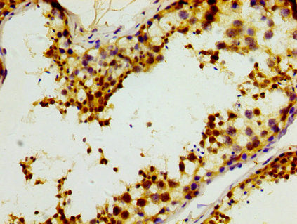 ITM2B Antibody