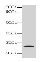 JAM2 Antibody