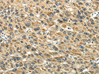 KEAP1 Antibody