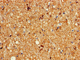 KCNC1 Antibody