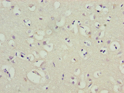 KCND1 Antibody