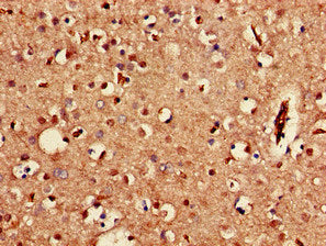 KCNJ3 Antibody