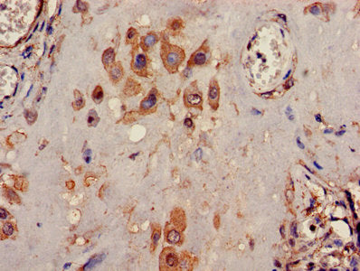 KCNK1 Antibody