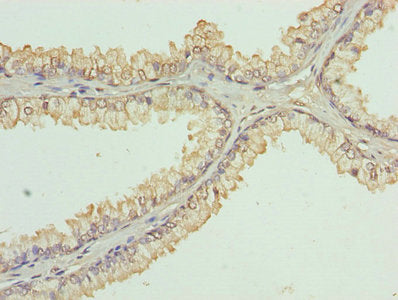 KDM5A Antibody
