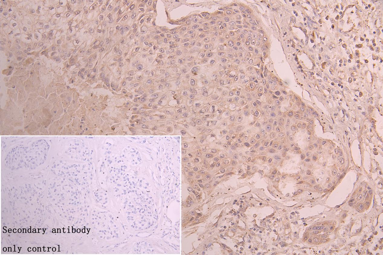 KERA Antibody