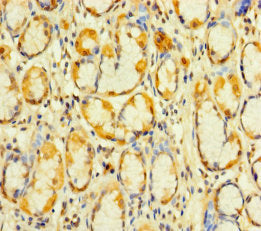 KIAA1324L Antibody
