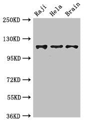 KIF11 Antibody