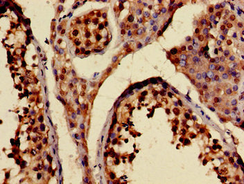 KIF20A Antibody