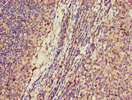 KIF2A Antibody