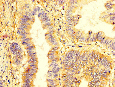 KIR2DL1 Antibody