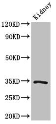 KLF7 Antibody