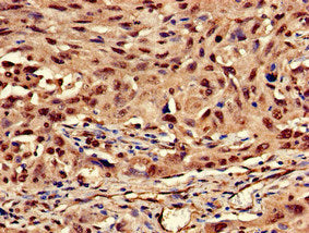 KRT13 Antibody