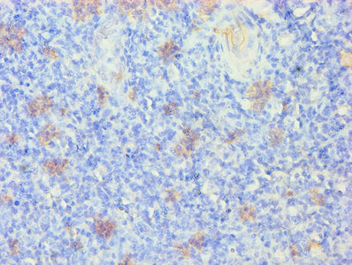 KRT14 Antibody