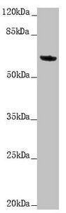KRT6A Antibody