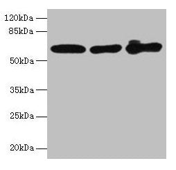 KRT6A Antibody