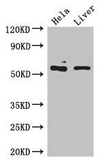KRT81 Antibody