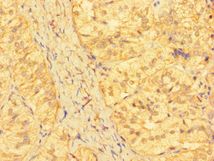 KRTAP23-1 Antibody