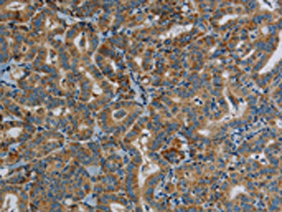 PPARGC1B Antibody