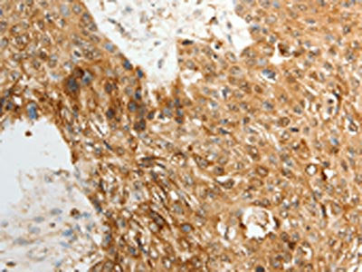 TENM3 Antibody