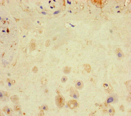 LATS1 Antibody