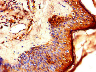 LCE1B Antibody