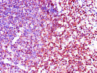 LCK Antibody