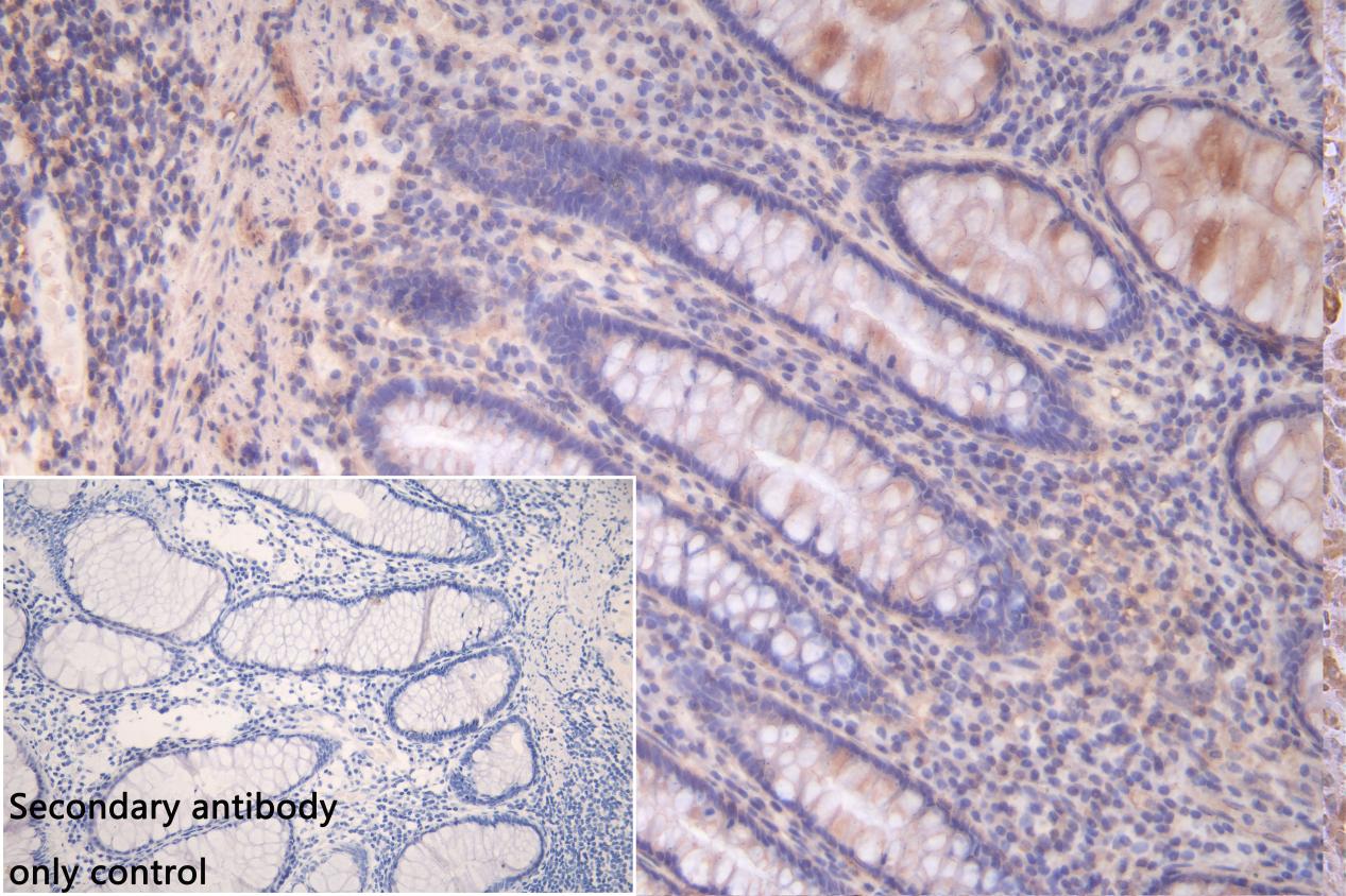 LCT Antibody