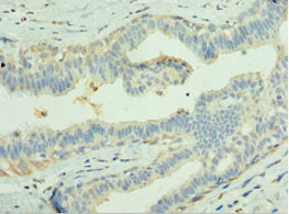LGI1 Antibody