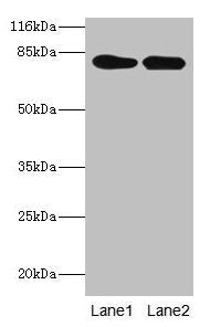 LHCGR Antibody