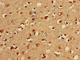 LIMK1 Antibody