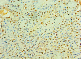 LIMK2 Antibody
