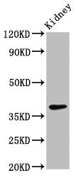 LIMS1 Antibody