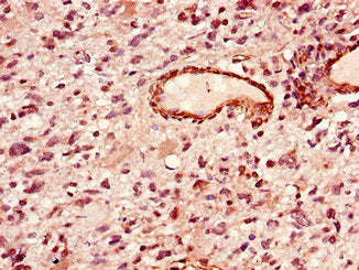 LIPE Antibody