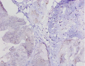LOXL1 Antibody