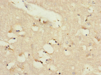 ADGRL2 Antibody
