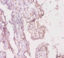 LRBA Antibody